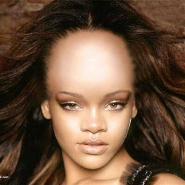Big forehead people