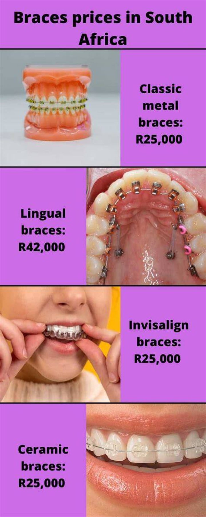 free braces in South Africa free braces in South Africa