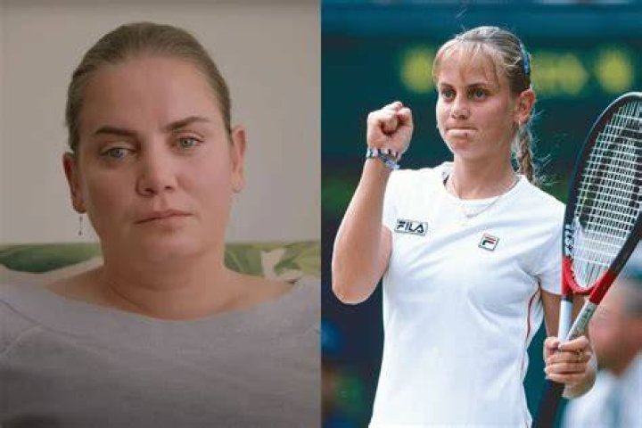 Jelena Dokic&rsquo;s images show her &ldquo;swollen, bruised and bleeding shins&rdquo; (red circles added). Photo / Instagram