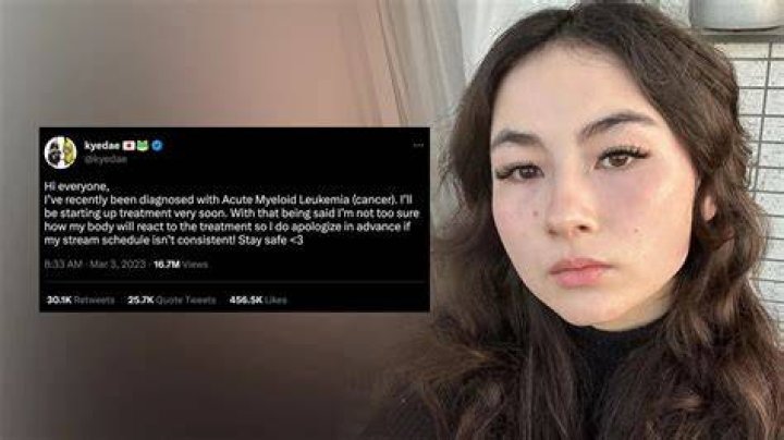Kyedae Cancer Reddit: Diagnosis, Age, Nationality, Twitch & Twitter Account
