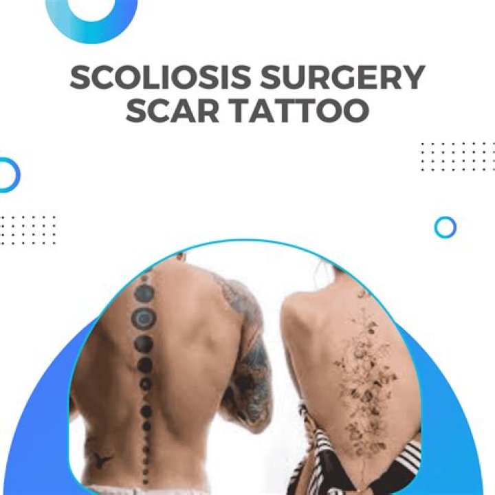 Scoliosis Surgery Scar Tattoo with Pictures Fitoont