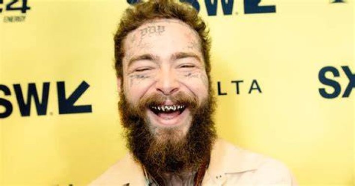 See Post Malone's $1.6 Million New Smile—Diamond Fangs Included