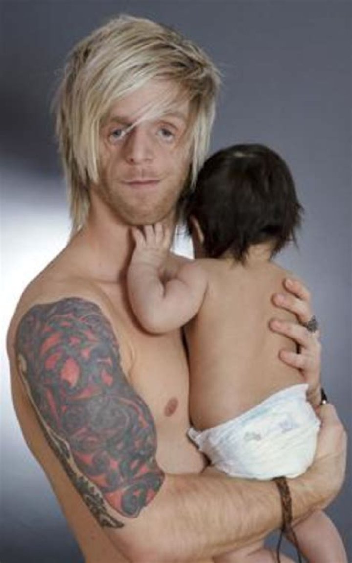 Treacher Collins Syndrome. Superstar Jono Lancaster gives a candid