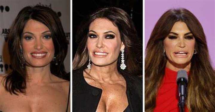 What Happened To Kimberly Guilfoyle S Face Image to u